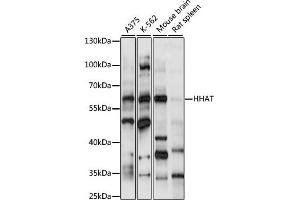 Western blot analysis of extracts of various cell lines, using HHAT antibody (ABIN7267598) at 1:1000 dilution. (HHAT antibody  (AA 1-100))