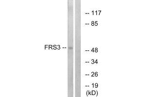 Western Blotting (WB) image for anti-Fibroblast Growth Factor Receptor Substrate 3 (FRS3) (Internal Region) antibody (ABIN1850386) (FRS3 antibody  (Internal Region))