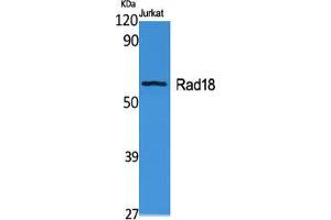 Western Blot (WB) analysis of specific cells using Rad18 Polyclonal Antibody.