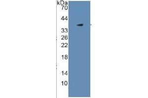 Western Blotting (WB) image for Plasminogen (PLG) ELISA Kit (ABIN6574264)