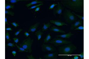 Immunofluorescence of monoclonal antibody to POLRMT on HeLa cell.