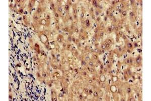 Immunohistochemistry of paraffin-embedded human liver tissue using ABIN7173617 at dilution of 1:100 (Tryptophan Hydroxylase 2 antibody  (AA 44-225))