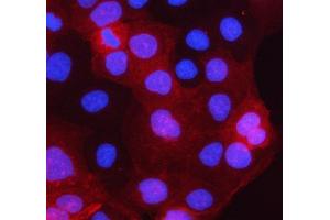 IF analysis of PCTP-L/STARD10 using anti-PCTP-L/STARD10 antibody (ABIN7599199). (STARD10 antibody  (AA 1-273))