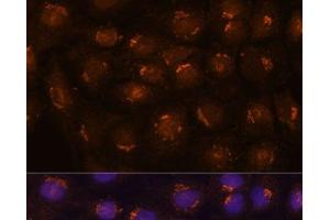 Immunofluorescence analysis of C6 cells using B3GNT4 Polyclonal Antibody at dilution of 1:100. (B3GNT4 antibody)