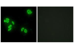 Immunofluorescence analysis of A549 cells, using TFIP8 antibody. (Cytokeratin 5 antibody  (Internal Region))