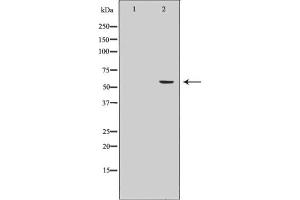 Western blot analysis of Cytochrome P450 19A1 Antibody expression in Human placenta tissue lysates. (Aromatase antibody  (Internal Region))