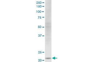 NDUFV2 monoclonal antibody (M03), clone 1A10. (NDUFV2 antibody  (AA 150-249))