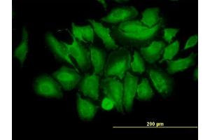 Immunofluorescence of monoclonal antibody to TRIM25 on HeLa cell.