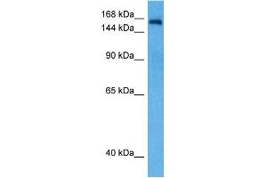 Host:  Rabbit  Target Name:  NCOA2  Sample Tissue:  Rat Brain  Antibody Dilution:  1ug/ml (NCOA2 antibody  (N-Term))