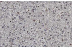 ABIN6267448 at 1/200 staining human Lymph nodes tissue sections by IHC-P. (CDK2 antibody  (pThr160))