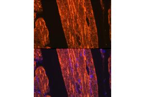 Immunofluorescence analysis of rat skeletal muscle using α-Actin-1  Rabbit mAb (ABIN3015986, ABIN3015987, ABIN1680683 and ABIN1680684) at dilution of 1:100 (40x lens). (Actin antibody)