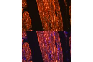 Immunofluorescence analysis of rat skeletal muscle using α-Actin-1  Rabbit mAb (ABIN3015986, ABIN3015987, ABIN1680683 and ABIN1680684) at dilution of 1:100 (40x lens). (Actin antibody)