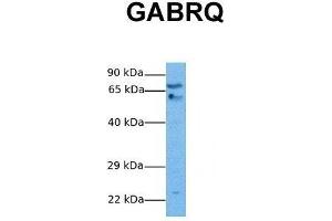 Host:  Rabbit  Target Name:  GABRQ  Sample Tissue:  Human Stomach Tumor  Antibody Dilution:  1. (GABRQ antibody  (N-Term))