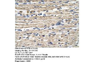 Rabbit Anti-GSTM2 Antibody  Paraffin Embedded Tissue: Human Muscle Cellular Data: Skeletal muscle cells Antibody Concentration: 4.