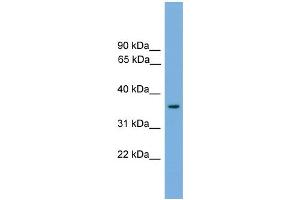 WB Suggested Anti-Foxf1a Antibody Titration: 0. (FOXF1 antibody  (Middle Region))