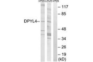 Western blot analysis of extracts from LOVO/HT-29 cells, using DPYSL4 Antibody.