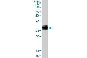 BST2 MaxPab rabbit polyclonal antibody. (BST2 antibody  (AA 1-180))
