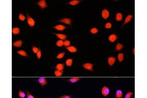 Immunofluorescence analysis of L929 cells using COMMD1 Polyclonal Antibody at dilution of 1:100. (COMMD1 antibody)