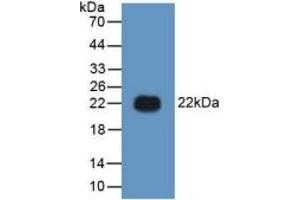 Western Blotting (WB) image for High Mobility Group Box 1 (HMGB1) ELISA Kit (ABIN6574155)