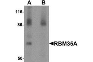 Western blot analysis of RBM35A in rat colon tissue lysate with RBM35A antibody at 0.