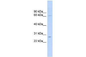 MRPL13 antibody used at 1 ug/ml to detect target protein. (MRPL13 antibody  (Middle Region))