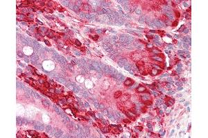 Anti-TXNDC5 / ERP46 antibody IHC staining of human small intestine. (TXNDC5 antibody  (AA 419-432))