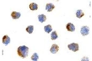 Immunohistochemistry (IHC) image for anti-Nerve Growth Factor Receptor (NGFR) antibody (ABIN1031777) (NGFR antibody)