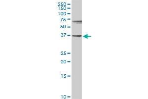 SULT1E1 antibody  (AA 1-294)