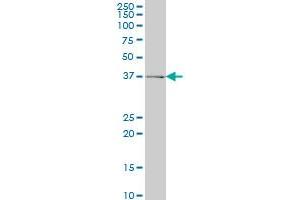 ADH6 monoclonal antibody (M01), clone 4G4 Western Blot analysis of ADH6 expression in K-562 . (ADH6 antibody  (AA 55-144))