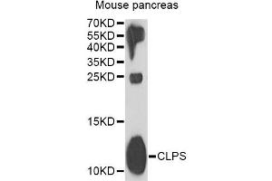 Western blot analysis of extracts of mouse pancreas, using CLPS antibody (ABIN2561908) at 1:1000 dilution. (CLPS antibody)