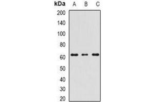 Western blot analysis of RIPK2 expression in MCF7 (A), mouse spleen (B), mouse testis (C) whole cell lysates. (RIPK2 antibody)