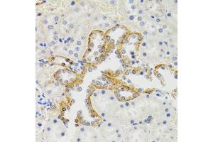 Immunohistochemistry of paraffin-embedded rat kidney using SH2B1 Antibody.