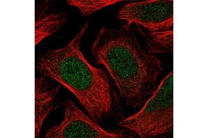 Immunofluorescent staining of human cell line U-2 OS with RBL1 polyclonal antibody  at 1-4 ug/mL concentration shows positivity in nucleus but excluded from the nucleoli.