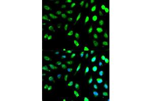 Immunofluorescence analysis of MCF7 cell using KLRD1 antibody. (CD94 antibody  (AA 32-179))