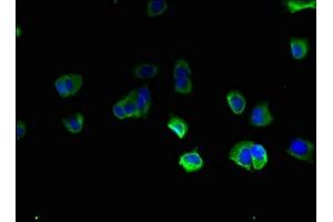 Immunofluorescent analysis of MCF-7 cells using ABIN7171610 at dilution of 1:100 and Alexa Fluor 488-congugated AffiniPure Goat Anti-Rabbit IgG(H+L) (TBC1D2 antibody  (AA 1-237))