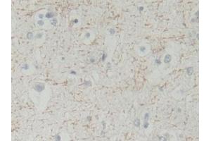 Detection of BLVRB in Human Cerebrum Tissue using Polyclonal Antibody to Biliverdin Reductase B (BLVRB)