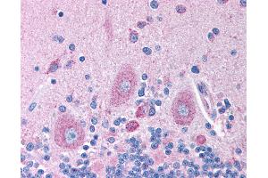 Immunohistochemistry (IHC) image for anti-gamma-aminobutyric Acid (GABA) A Receptor, beta 2 (GABRB2) (AA 143-192) antibody (ABIN6736385)