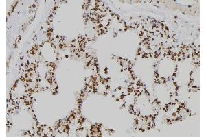 ABIN6258363 and ABIN6273562 at 1/100 staining Rat lung tissue by IHC-P. (ZNF440 antibody  (C-Term))