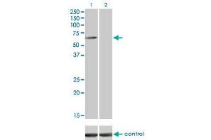 Western blot analysis of CAMKK1 over-expressed 293 cell line, cotransfected with CAMKK1 Validated Chimera RNAi (Lane 2) or non-transfected control (Lane 1). (CAMKK1 antibody  (AA 1-520))