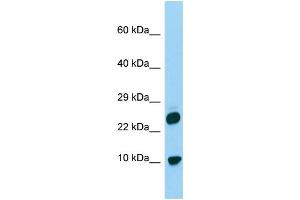 Host: Rabbit Target Name: H2AFV Sample Type: 293T Whole Cell lysates Antibody Dilution: 1. (H2AFV antibody  (N-Term))
