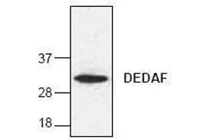 Image no. 1 for anti-RING1 and YY1 Binding Protein (RYBP) antibody (ABIN155069)
