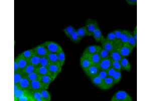 Immunofluorescence analysis of PC-12 cells using ARRB1 antibody (ABIN5996907). (beta Arrestin 1 antibody)