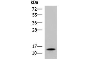 Western blot analysis of Mouse serum using TTR Polyclonal Antibody at dilution of 1:600 (TTR antibody)
