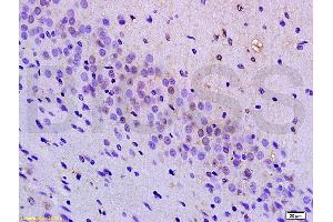 Formalin-fixed and paraffin embedded mouse brain tissue labeled with Anti-BRN3A Polyclonal Antibody, Unconjugated (ABIN702400) at 1:200 followed by conjugation to the secondary antibody, (SP-0023), and DAB staining (POU4F1 antibody  (AA 325-419))