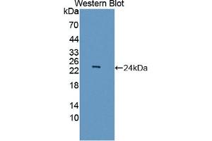 Detection of Recombinant ASCL1, Human using Polyclonal Antibody to Achaete Scute Complex Like Protein 1 (ASCL1) (Achaete Scute Complex Like Protein 1 (AA 84-236) antibody)