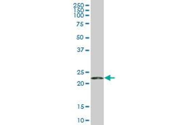RPS5 antibody  (AA 106-204)