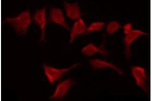 ABIN6269280 staining HepG2 by IF/ICC. (BMX antibody  (C-Term))