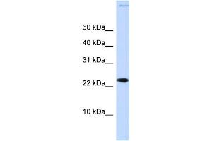 WB Suggested Anti-CHRAC1 Antibody Titration:  0. (CHRAC1 antibody  (Middle Region))