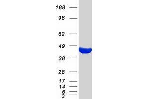 Western Blotting (WB) image for Acetyl-CoA Acetyltransferase 2 (ACAT2) protein (Myc-DYKDDDDK Tag) (ABIN2714307)