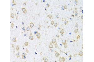 Immunohistochemistry of paraffin-embedded Mouse brain using COTL1 Polyclonal Antibody at dilution of 1:100 (40x lens). (COTL1 antibody)